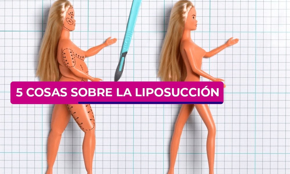 Cosas que no sabías de la liposucción