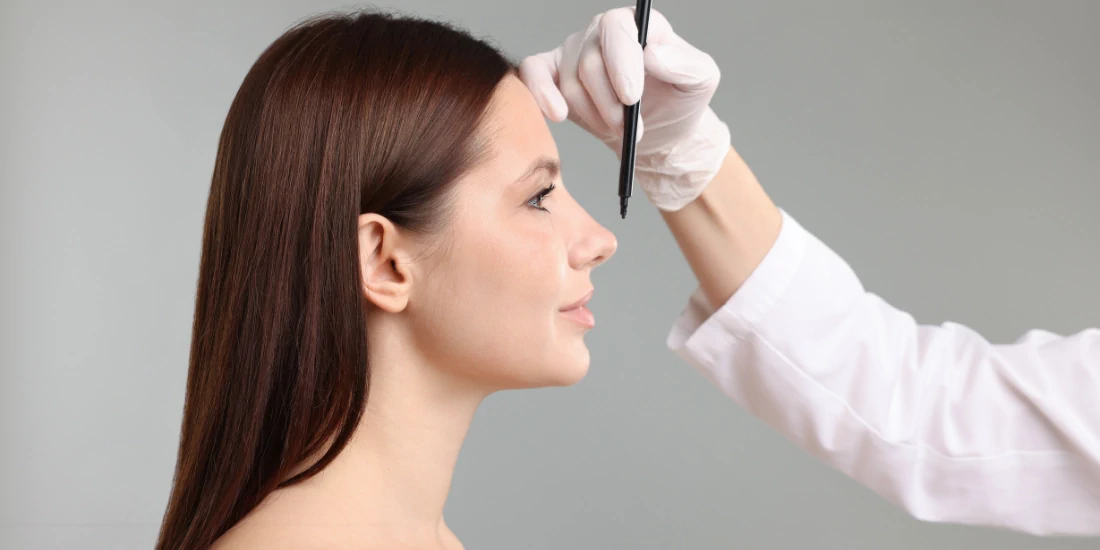 Cirujana marcando líneas de planificación en perfil nasal de paciente — consulta preoperatoria de rinoplastia