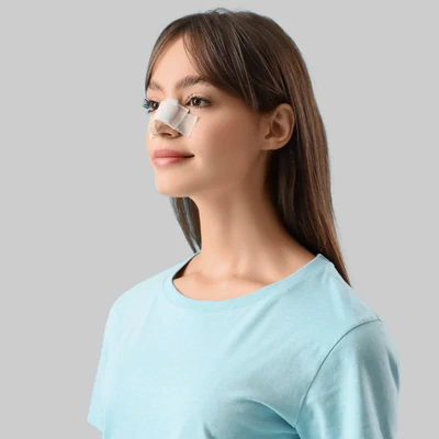 Evolución postoperatoria de rinoplastia — seguimiento del edema y estabilización