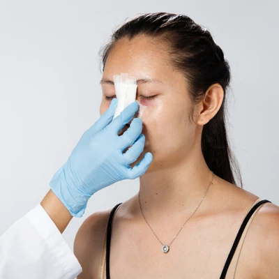 Paciente con férula nasal durante recuperación postoperatoria de rinoplastia
