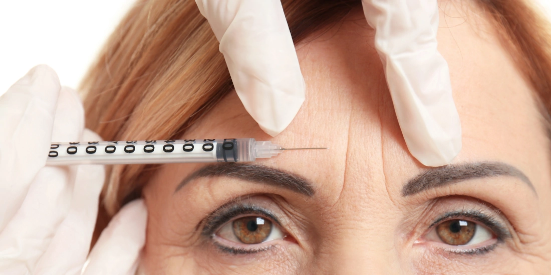 Microinjertos y nanoinjertos de grasa autóloga para rejuvenecimiento facial