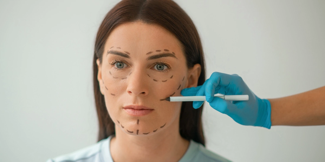 Revisión preoperatoria de medicamentos y suplementos antes del lifting facial